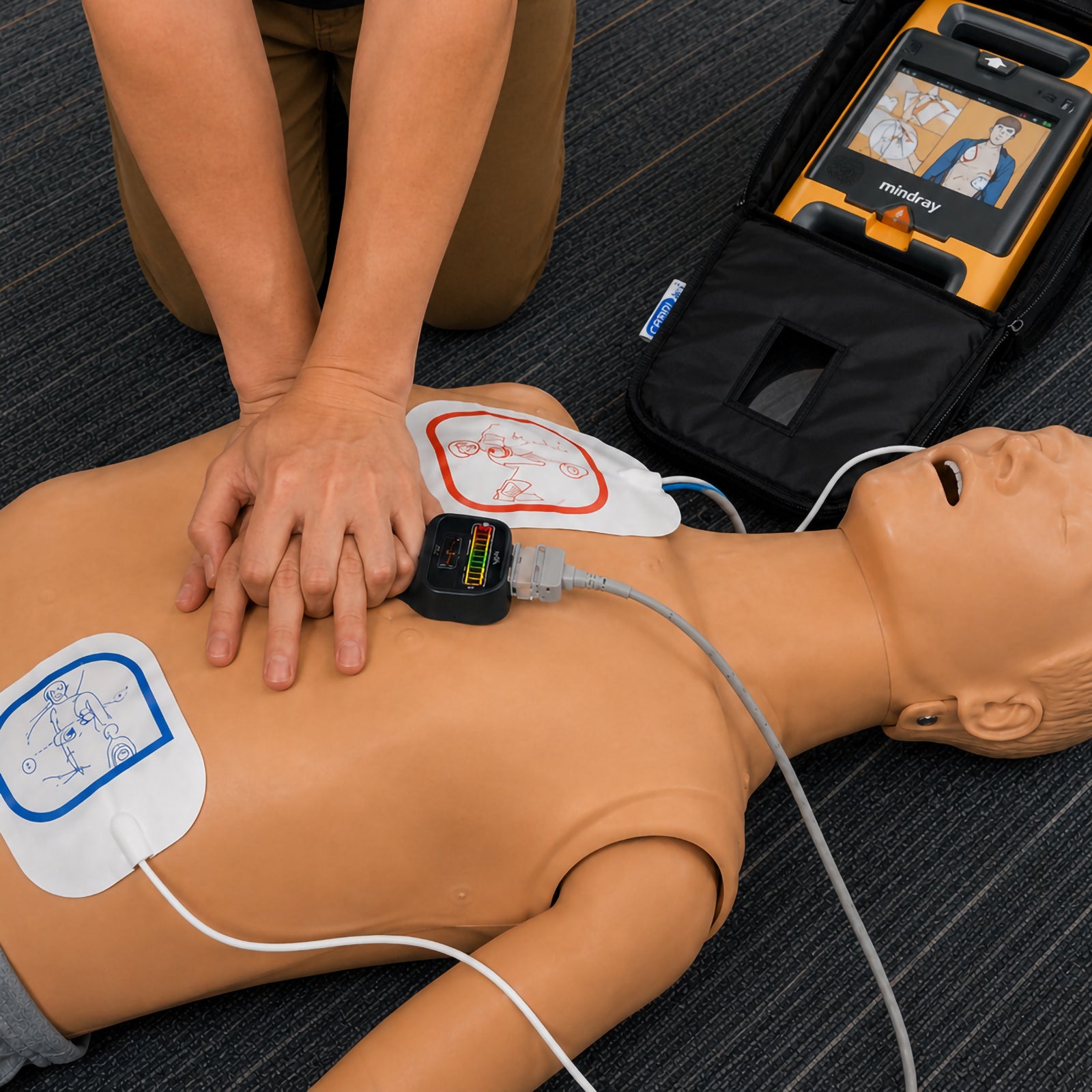 CardiAct Mindray Soft Carry Case opened beside a CPR training manikin during a simulated cardiac emergency, with a Mindray AED operating inside the case while a rescuer performs chest compressions. Electrode pads and connected leads demonstrate how the carry case supports rapid access to the defibrillator during emergency response training.