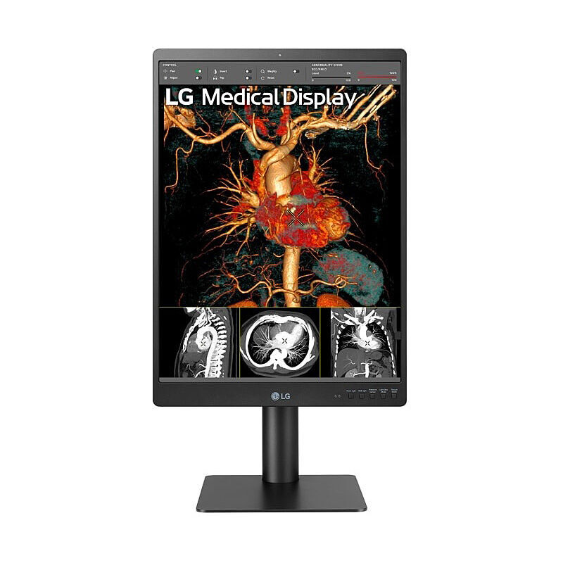 Front view of the LG 21HQ513D-S 21-inch 3MP portrait diagnostic monitor in white showing the display and stand on a white background