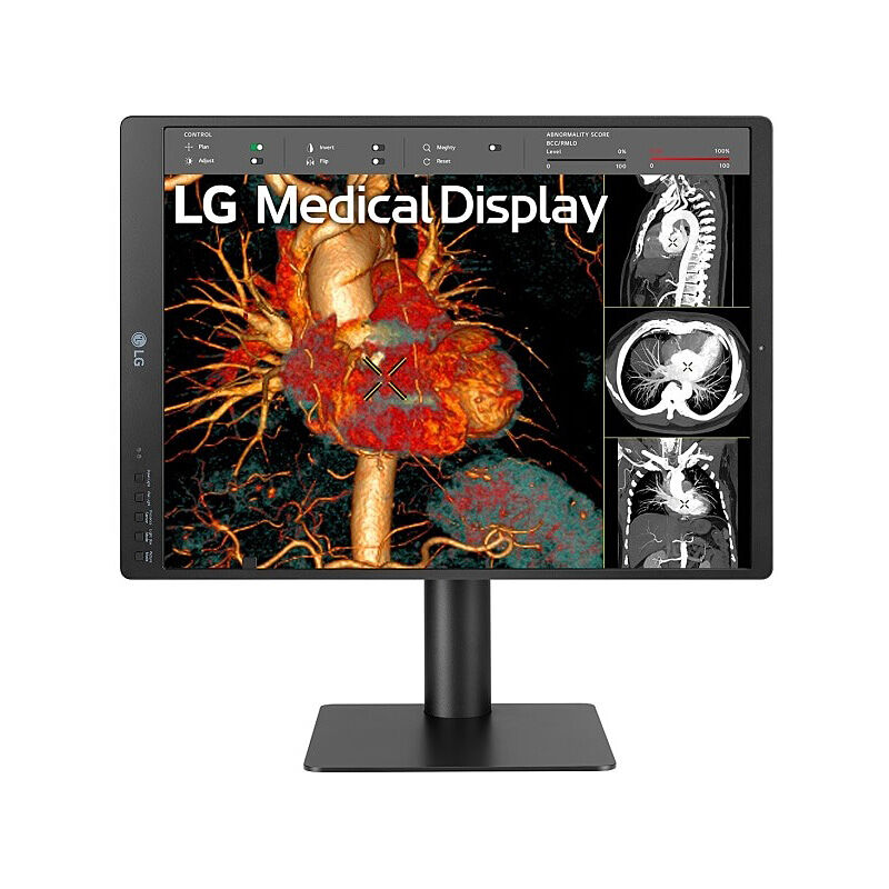 Angled view of the LG 21HQ513D-S 21-inch diagnostic monitor highlighting the portrait orientation and adjustable stand
