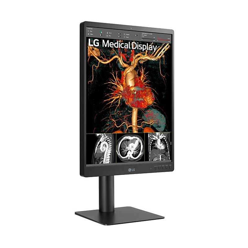Rear view of the LG 21HQ513D-S 21-inch diagnostic monitor showing the input ports and stand mount