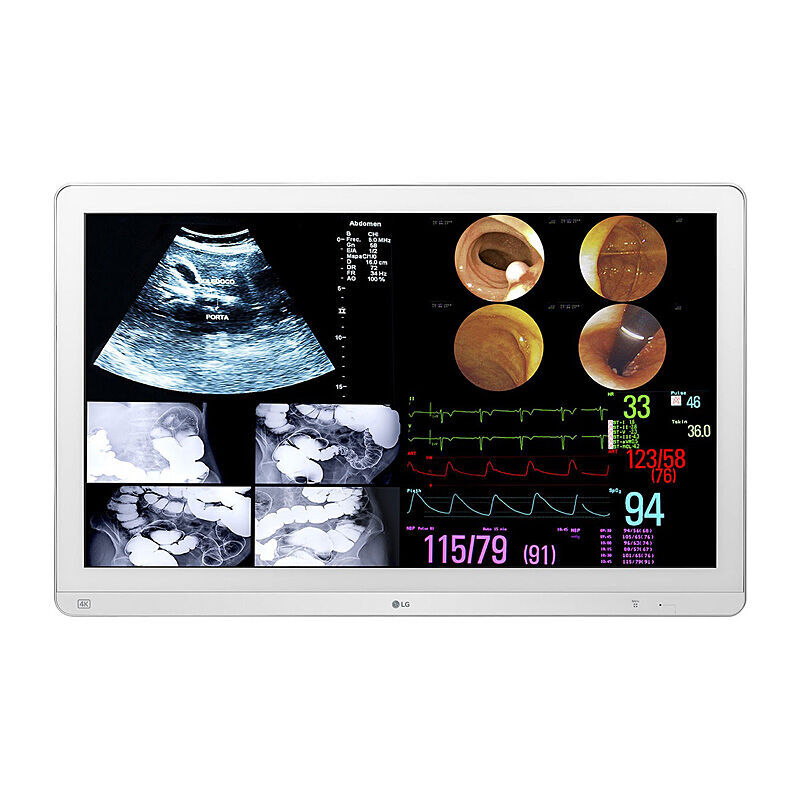 Front view of the LG 32HL714S-W 31.5-inch 4K surgical monitor in white showing the display and stand on a white background
