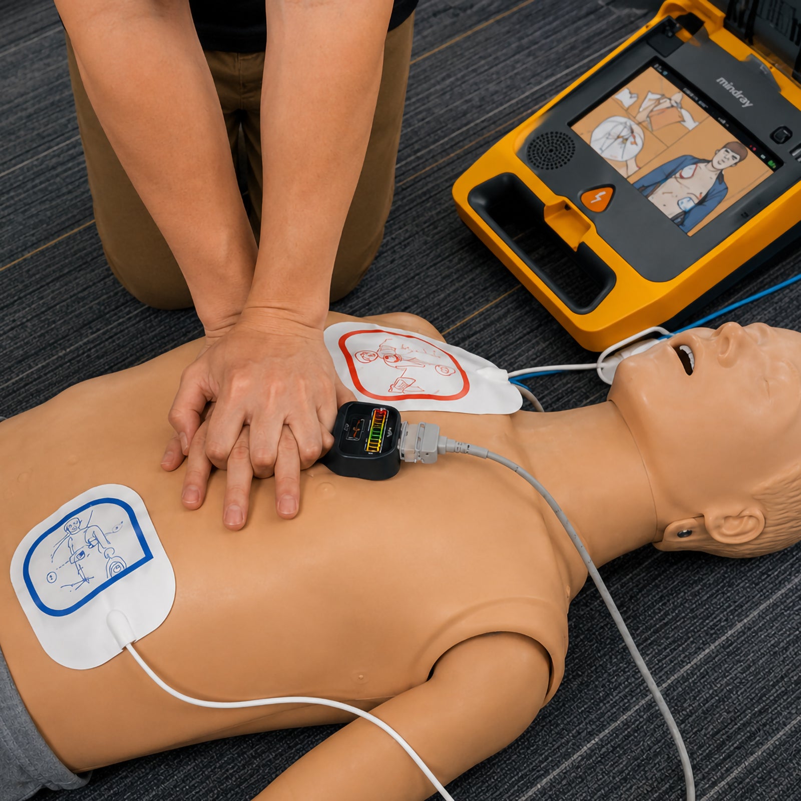 Mindray CPR Sensor positioned on a CPR training manikin during chest compressions with electrode pads attached and a compatible Mindray BeneHeart AED operating nearby. The training scene demonstrates how the sensor sits beneath the rescuer's hands to monitor compression performance while the AED provides visual rescue guidance.