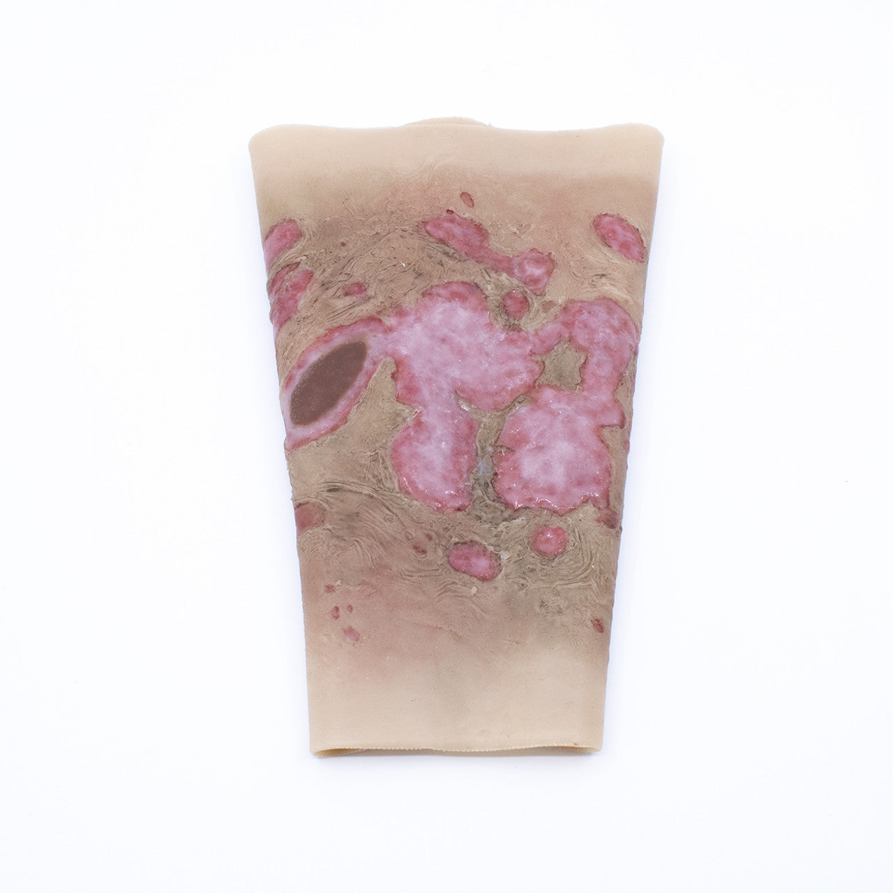 TraumaSim Wearable Large Burn Forearm realistic wearable burn for training scenarios