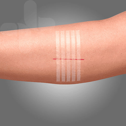 Aeroplast Wound Closure Strips 3 x 75mm Box of 50 (5 Strips per Card)