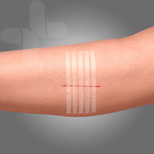 Aeroplast Wound Closure Strips 6 x 100mm Box of 50 (10 Strips per Card)