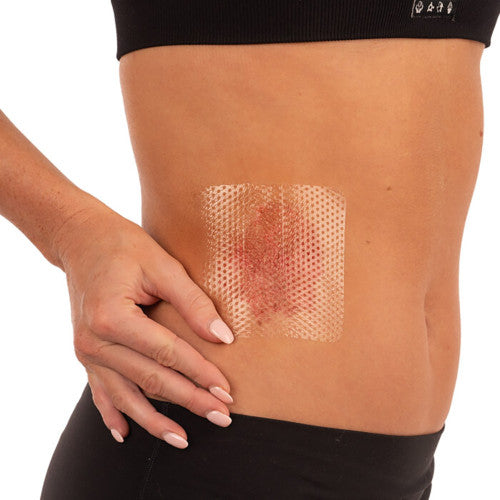 Aerowound Silicone Wound Contact Dressing 10 x 10cm