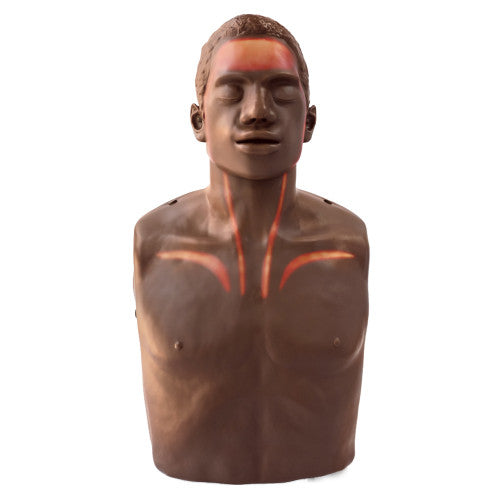 Brayden OBI Conversion Kit