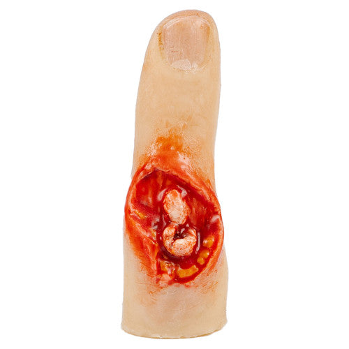 TraumaSim Finger Glove Exposed Bone Injury