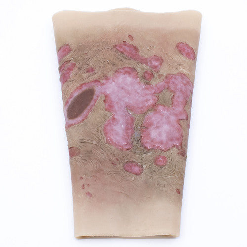 TRAUMASIM WEARABLE LARGE BURN - FOREARM