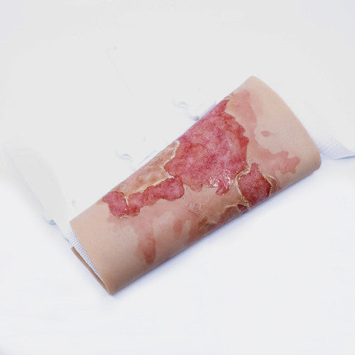 TRAUMASIM WEARABLE LARGE BURN - UPPER LEG