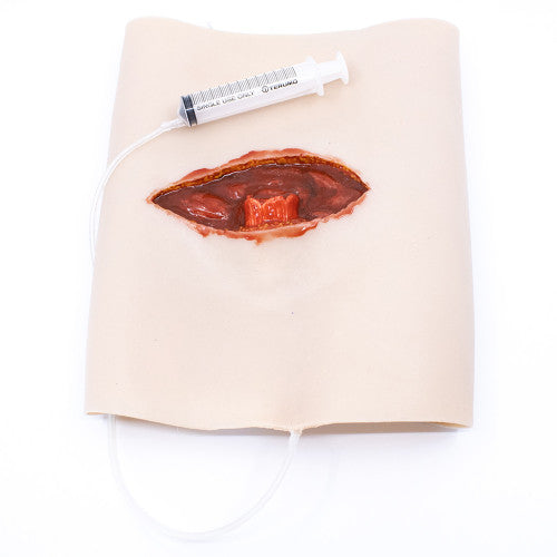 TRAUMASIM WEARABLE OPEN FEMUR FRACTURE - UPPER LEG WITH BLEEDING CAPACITY