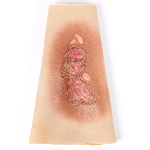 TRAUMASIM WEARABLE SMALL BURN - FOREARM